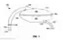 Fig. 02 - Devices and methods for blood flow assistance