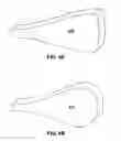Fig. 05 - Devices and methods for blood flow assistance
