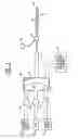 Fig. 02 - Timing of intra-aortic balloon pump therapy