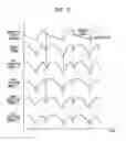 Fig. 04 - Timing of intra-aortic balloon pump therapy