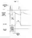 Fig. 09 - Timing of intra-aortic balloon pump therapy