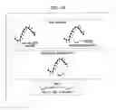 Fig. 12 - Timing of intra-aortic balloon pump therapy
