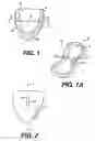 Fig. 02 - Transventricular implant tools and devices