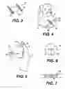 Fig. 03 - Transventricular implant tools and devices
