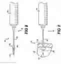 Fig. 04 - Transventricular implant tools and devices