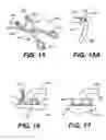 Fig. 08 - Transventricular implant tools and devices