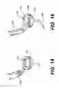 Fig. 09 - Transventricular implant tools and devices