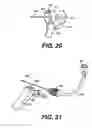 Fig. 10 - Transventricular implant tools and devices
