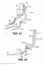 Fig. 13 - Transventricular implant tools and devices