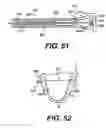 Fig. 20 - Transventricular implant tools and devices