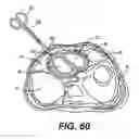Fig. 24 - Transventricular implant tools and devices