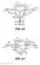 Fig. 28 - Transventricular implant tools and devices