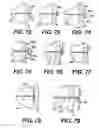 Fig. 31 - Transventricular implant tools and devices