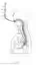 Fig. 02 - Method and apparatus for performing transgastric procedures