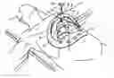 Fig. 01 - Transabdominal surgery system