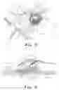 Fig. 02 - Transabdominal surgery system