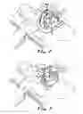 Fig. 03 - Transabdominal surgery system