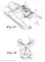 Fig. 05 - Transabdominal surgery system