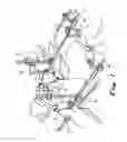Fig. 06 - Transabdominal surgery system
