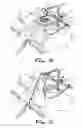 Fig. 08 - Transabdominal surgery system