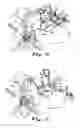 Fig. 10 - Transabdominal surgery system