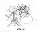 Fig. 11 - Transabdominal surgery system