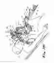 Fig. 15 - Transabdominal surgery system