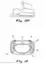 Fig. 16 - Transabdominal surgery system