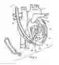Fig. 06 - Device to permit offpump beating heart coronary bypass surgery