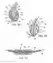 Fig. 07 - Device to permit offpump beating heart coronary bypass surgery
