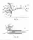 Fig. 09 - Device to permit offpump beating heart coronary bypass surgery