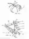 Fig. 12 - Device to permit offpump beating heart coronary bypass surgery