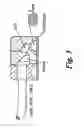 Fig. 04 - Optical device