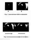 Fig. 02 - Stereo display of tube-like structures and improved techniques therefor (