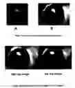 Fig. 03 - Stereo display of tube-like structures and improved techniques therefor (