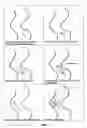 Fig. 32 - Stereo display of tube-like structures and improved techniques therefor (