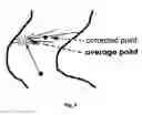 Fig. 34 - Stereo display of tube-like structures and improved techniques therefor (
