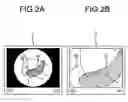 Fig. 03 - Diagnosis supporting device