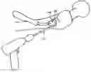 Fig. 01 - Enhanced graphic features for computer assisted surgery system