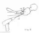 Fig. 03 - Enhanced graphic features for computer assisted surgery system