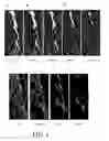 Fig. 02 - Method for bone structure prognosis and simulated bone remodeling