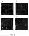Fig. 05 - Method for bone structure prognosis and simulated bone remodeling