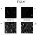 Fig. 07 - Method for bone structure prognosis and simulated bone remodeling