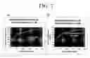 Fig. 08 - Method for bone structure prognosis and simulated bone remodeling