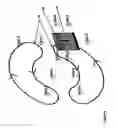 Fig. 06 - Method and assembly for magnetic resonance imaging and catheter sterring