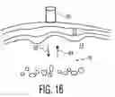 Fig. 13 - Ultrasonic imaging aberration correction with microbeamforming