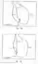 Fig. 09 - Apparatus and method for cardiac ablation