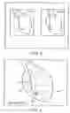 Fig. 10 - Apparatus and method for cardiac ablation