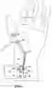Fig. 03 - Nerve stimulator measuring device