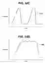 Fig. 20 - Apparatus containing a receiving element for treatment of skin